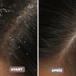 Peigne Anti-Pellicules Auto-nettoyant & Antistatique