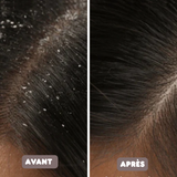 Peigne Anti-Pellicules Auto-nettoyant & Antistatique