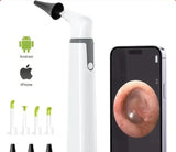Otoscope d'oreilles avec caméra intégrée WiFi - Kit complet