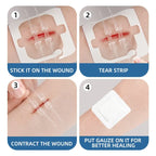 2x Pansements de Suture pour Plaie à Glissière