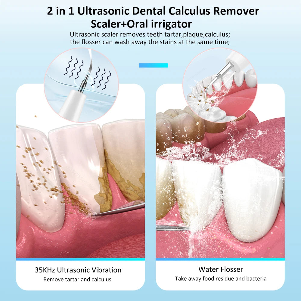 Irrigateur dentaire ultrasonique 2 en 1