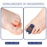 Attelle Redresseur pour Orteils Marteau et Griffe - 1 ACHETÉE = 1 OFFERTE