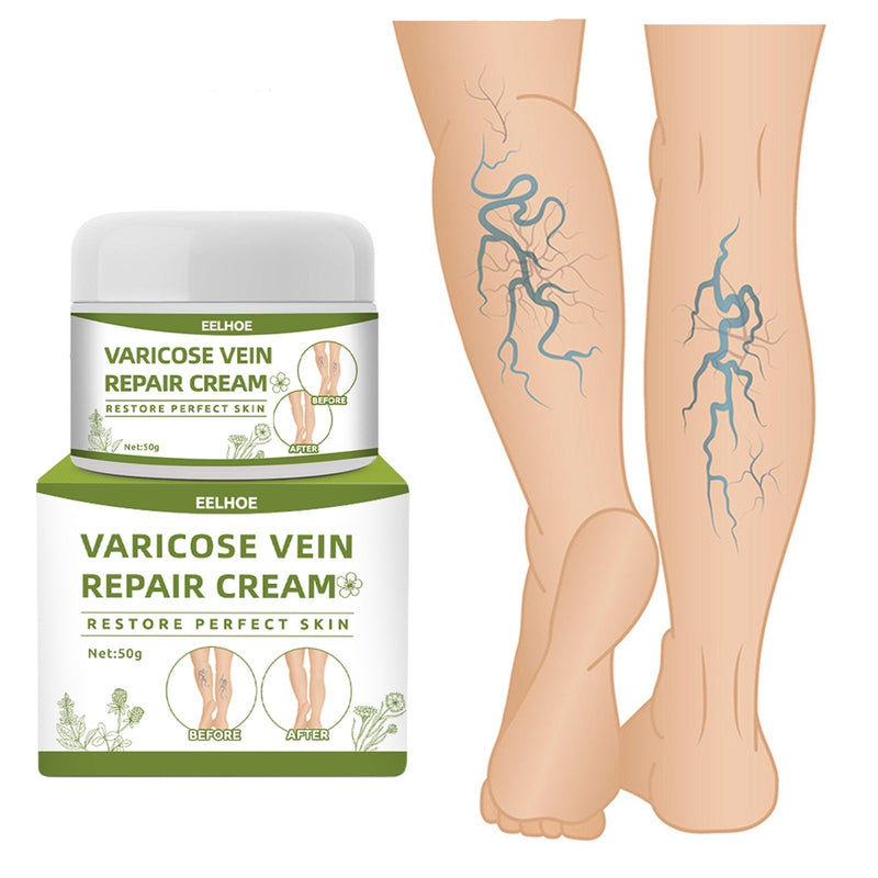 VeinsCare - La crème magique anti-varices